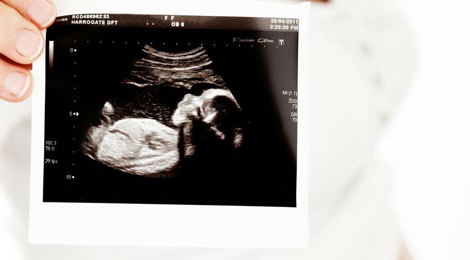 Ist Ultraschall Schädlich Fürs Baby www.babyclub.de